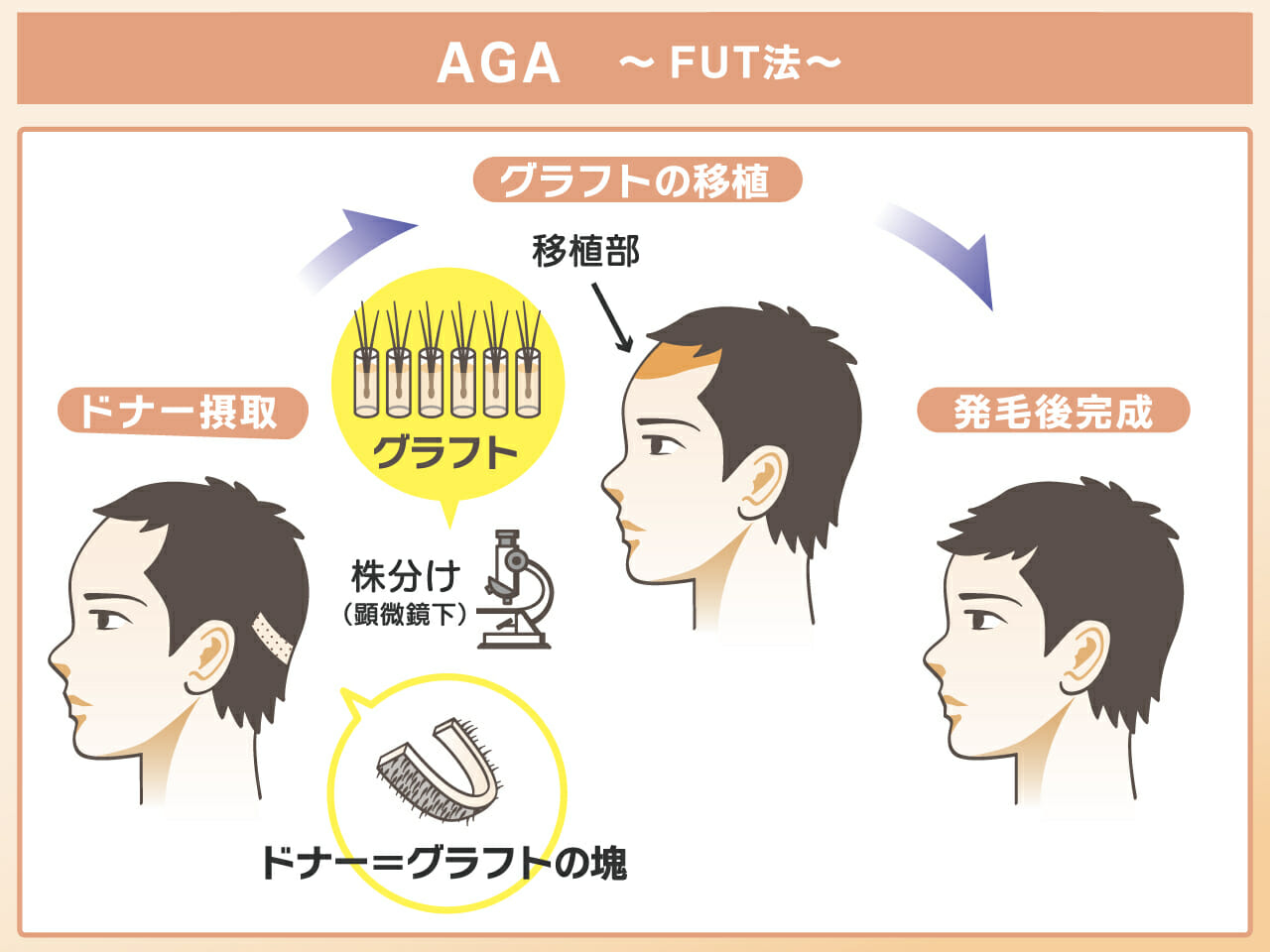 AGA